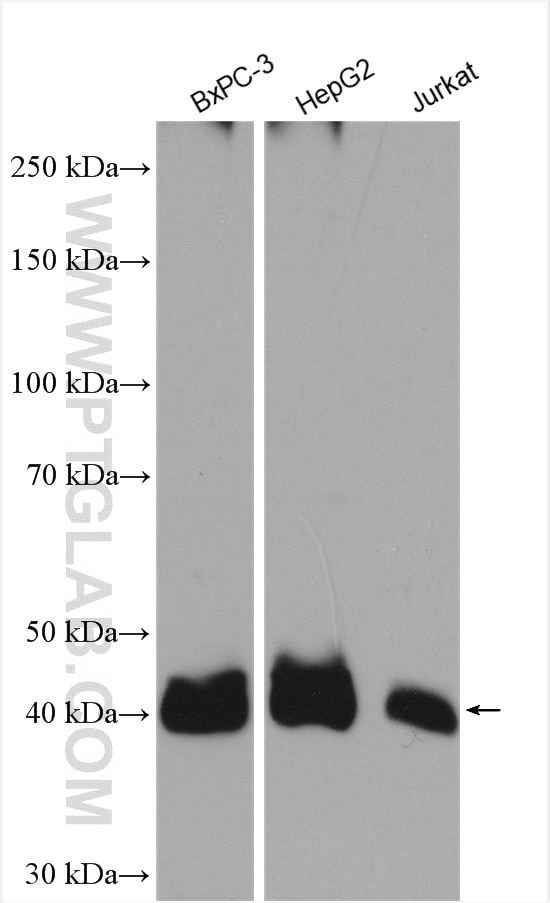 Western Blot (WB) analysis of various lysates using MCT1 Polyclonal antibody (20139-1-AP)
