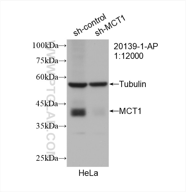 Western Blot (WB) analysis of HeLa cells using MCT1 Polyclonal antibody (20139-1-AP)