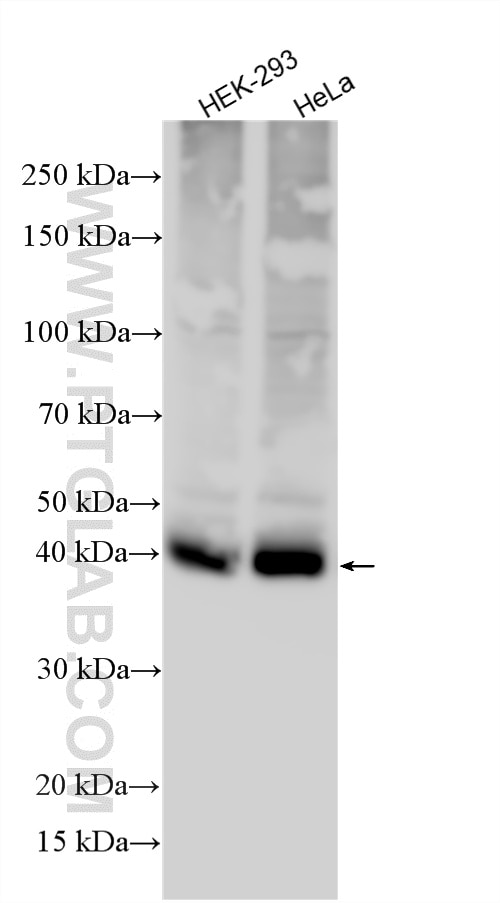 Various lysates were subjected to SDS PAGE followed by western blot with 20139-1-AP (MCT1 antibody) at dilution of 1:8000 incubated at room temperature for 1.5 hours. Western Blot (WB) analysis of various lysates using MCT1 Polyclonal antibody (20139-1-AP)