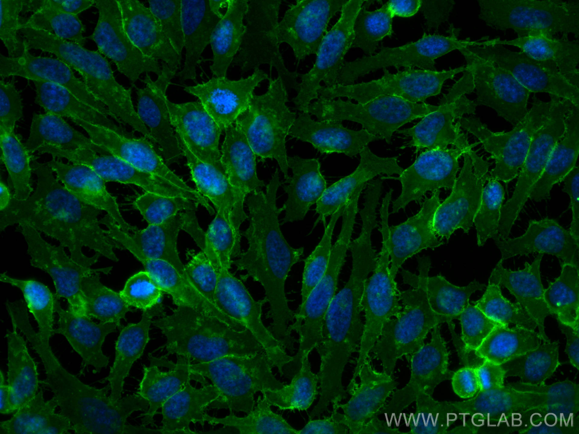 Immunofluorescence (IF) / fluorescent staining of HeLa cells using CoraLite® Plus 488-conjugated MCT1 Polyclonal anti (CL488-20139)