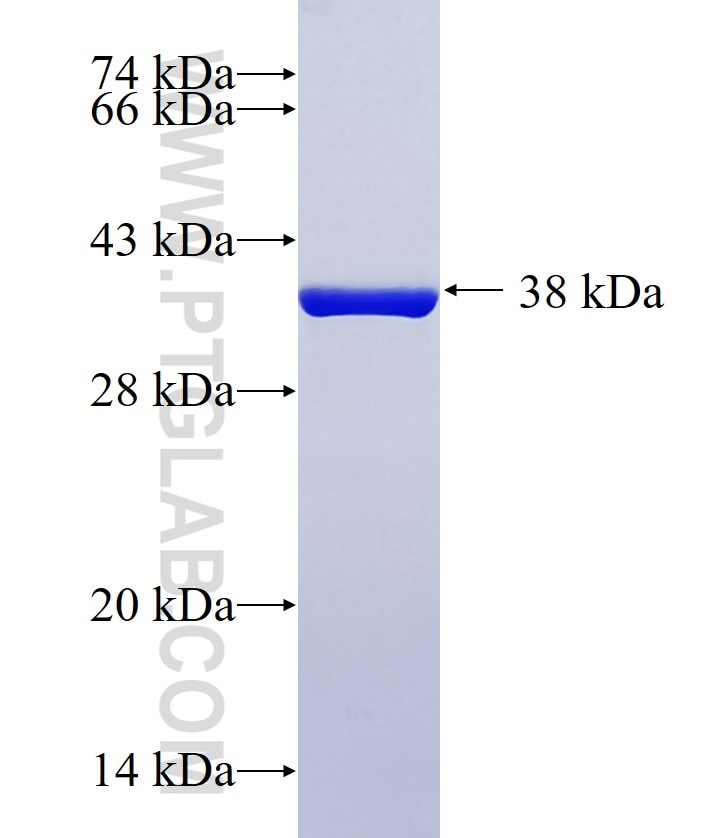 MCT1 fusion protein Ag14098 SDS-PAGE