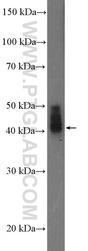 Western Blot (WB) analysis of pig kidney tissue using MCT14 Polyclonal antibody (26953-1-AP)