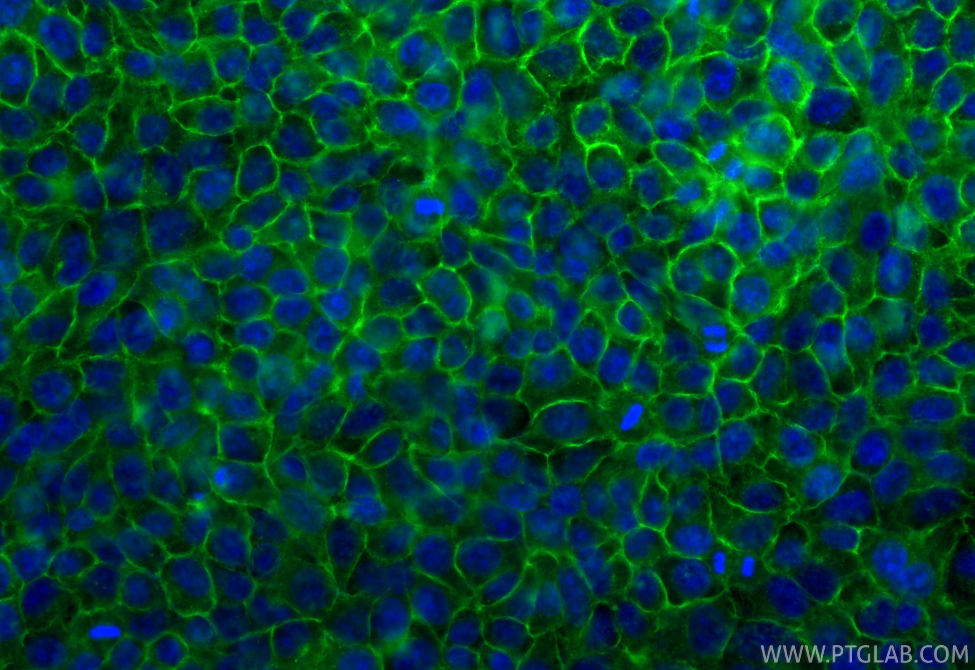 Immunofluorescent analysis of (-20°C Ethanol) fixed HepG2 cells using MCT4 antibody (84797-4-RR, Clone: 242296E3 ) at dilution of 1:1000 and CoraLite®488-Conjugated Goat Anti-Rabbit IgG(H+L) (SA00013-2). Immunofluorescence (IF) / fluorescent staining of HepG2 cells using MCT4 Recombinant monoclonal antibody (84797-4-RR)