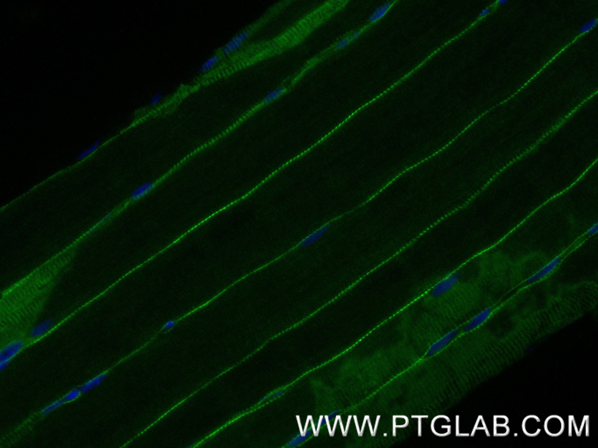 Immunofluorescent analysis of (4% PFA) fixed paraffin-embedded rat skeletal muscle tissue using MCT4 antibody (84797-4-RR, Clone: 242296E3 ) at dilution of 1:500 and CoraLite®488-Conjugated Goat Anti-Rabbit IgG(H+L) (SA00013-2). Heat mediated antigen retrieval with Tris-EDTA buffer (pH 9.0). Immunofluorescence (IF) / fluorescent staining of rat skeletal muscle tissue using MCT4 Recombinant monoclonal antibody (84797-4-RR)