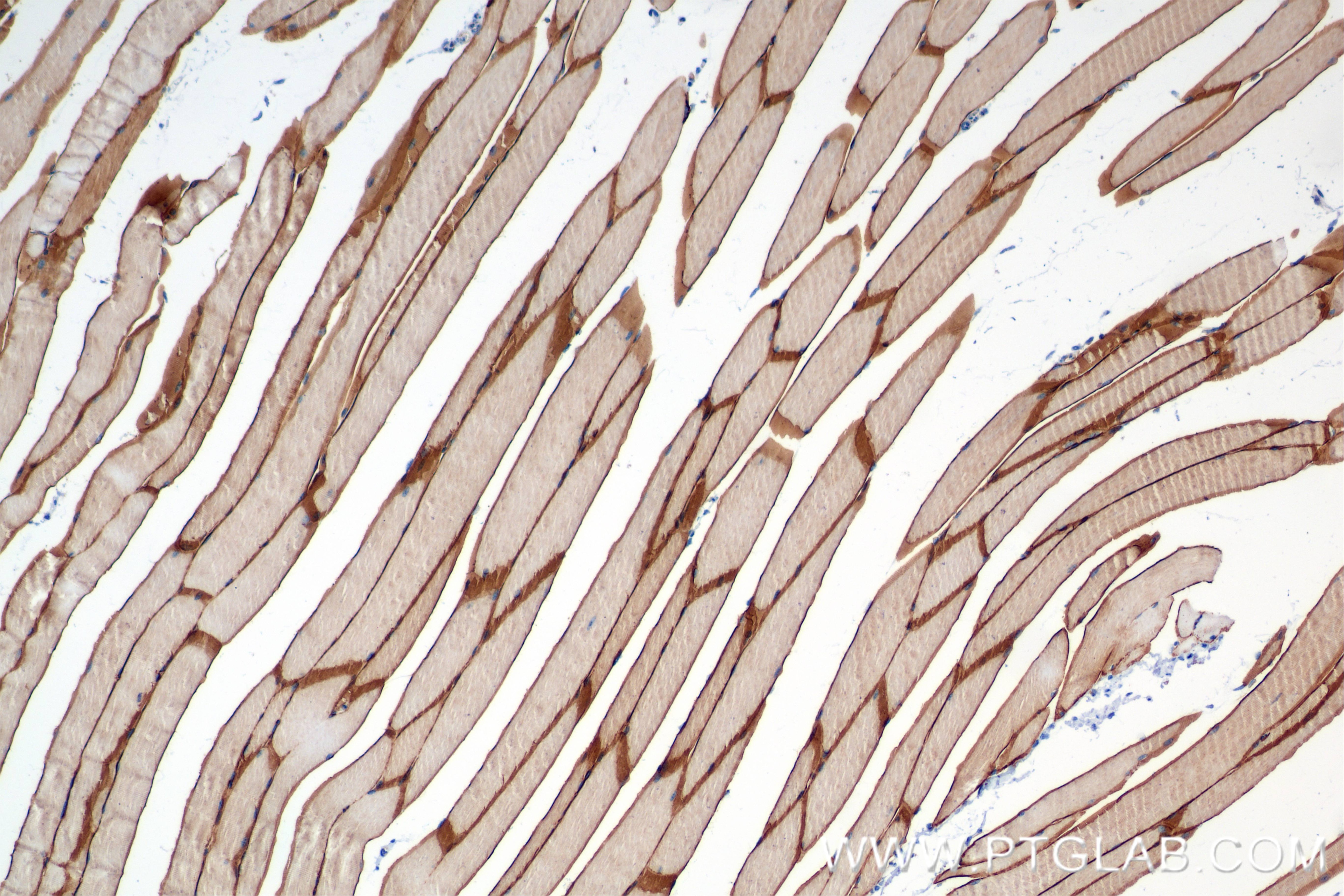 Immunohistochemistry (IHC) staining of mouse skeletal muscle tissue using MCT4 Recombinant antibody (84797-4-RR)