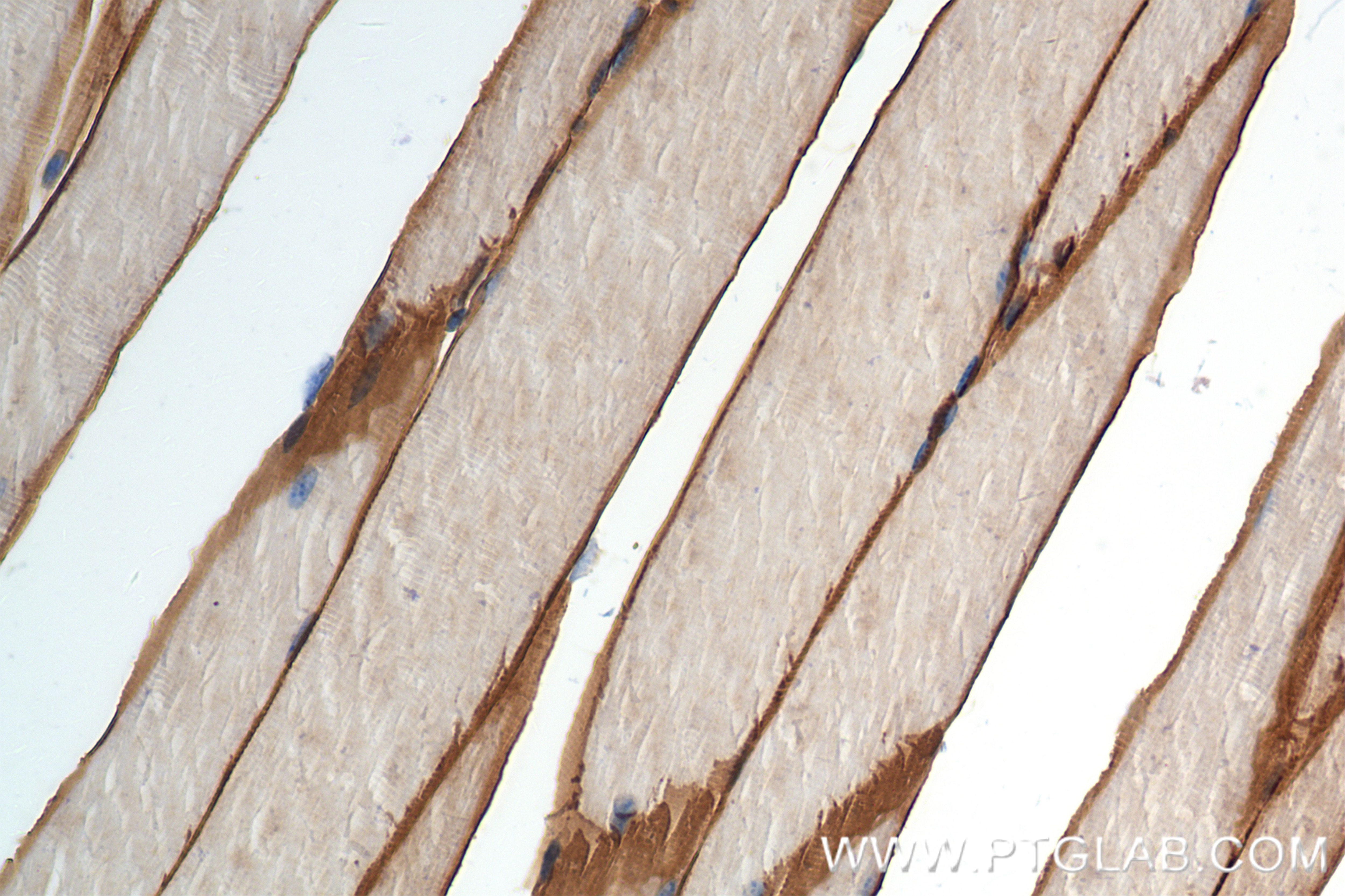 Immunohistochemistry (IHC) staining of mouse skeletal muscle tissue using MCT4 Recombinant antibody (84797-4-RR)