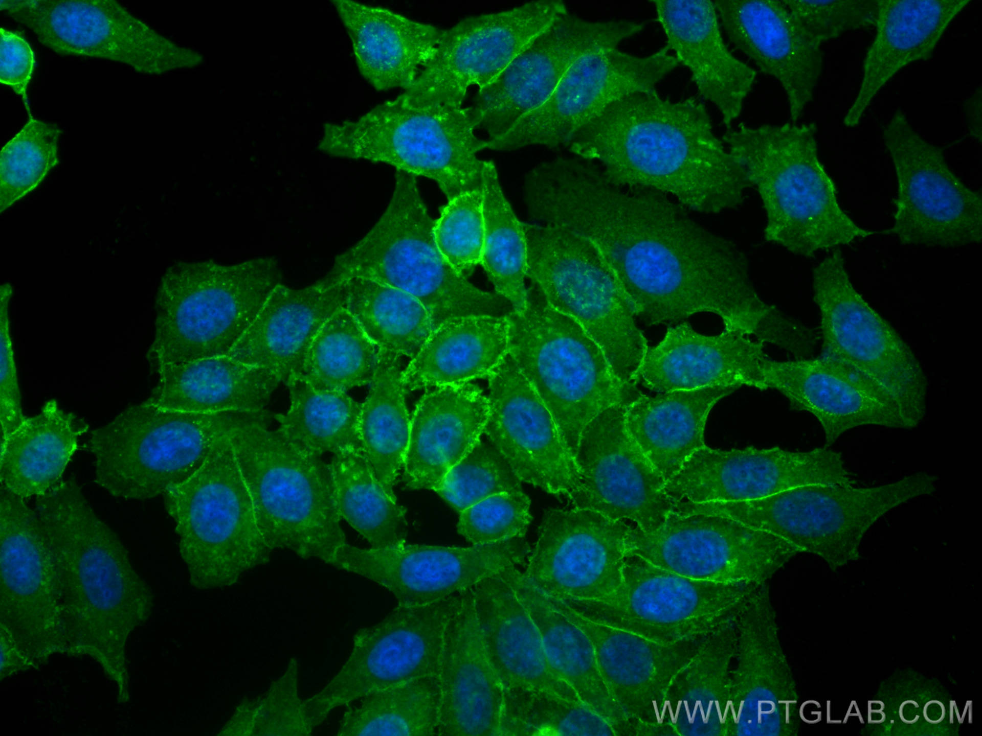 Immunofluorescence (IF) / fluorescent staining of HepG2 cells using CoraLite® Plus 488-conjugated MCT4 Polyclonal anti (CL488-22787)