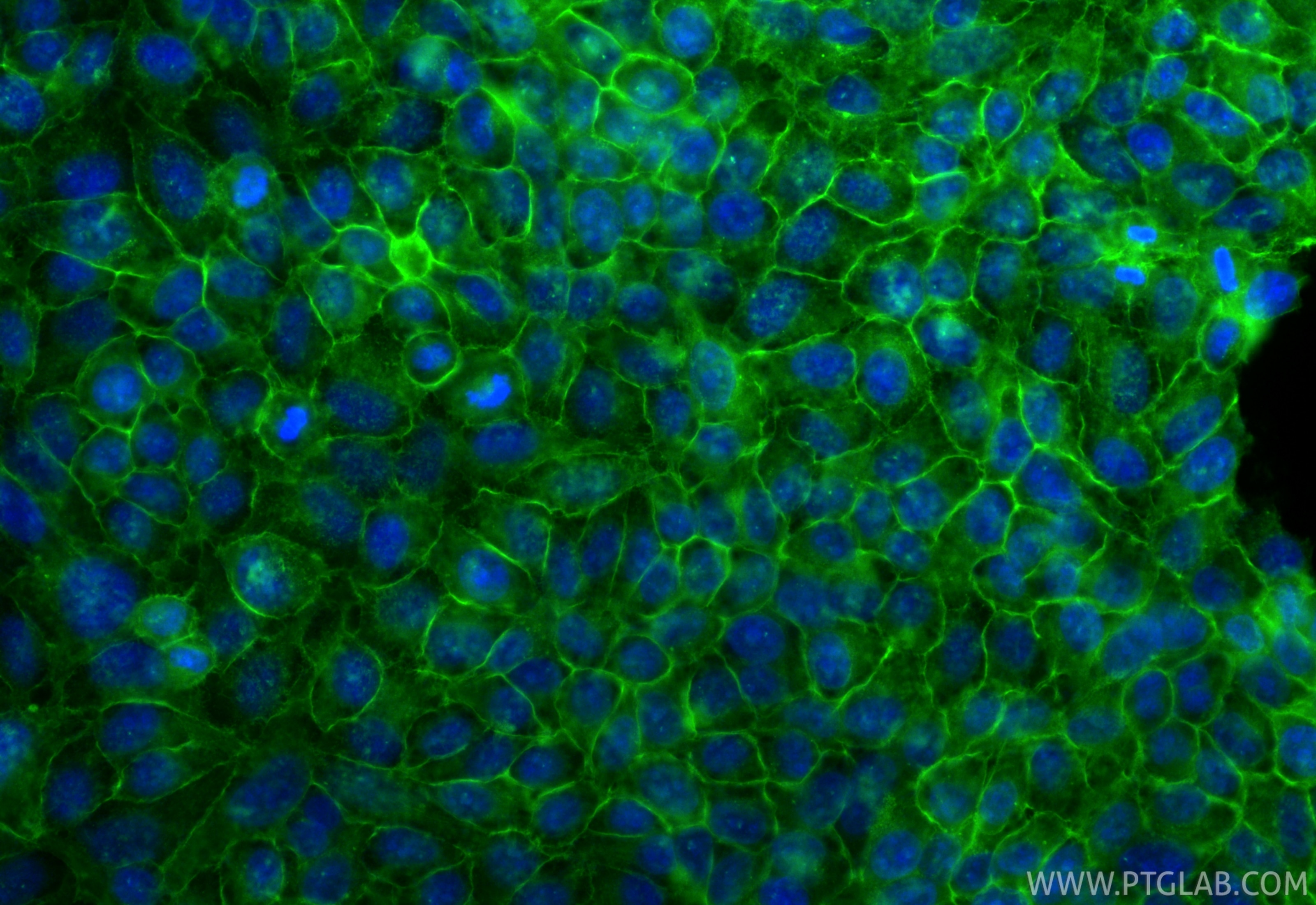 Immunofluorescent analysis of (-20°C Ethanol) fixed HepG2 cells using CoraLite® Plus 488 MCT4 antibody (CL488-84797-4, Clone: 242296E3 ) at dilution of 1:200. Immunofluorescence (IF) / fluorescent staining of HepG2 cells using CoraLite® Plus 488-conjugated MCT4 Recombinant mon (CL488-84797-4)