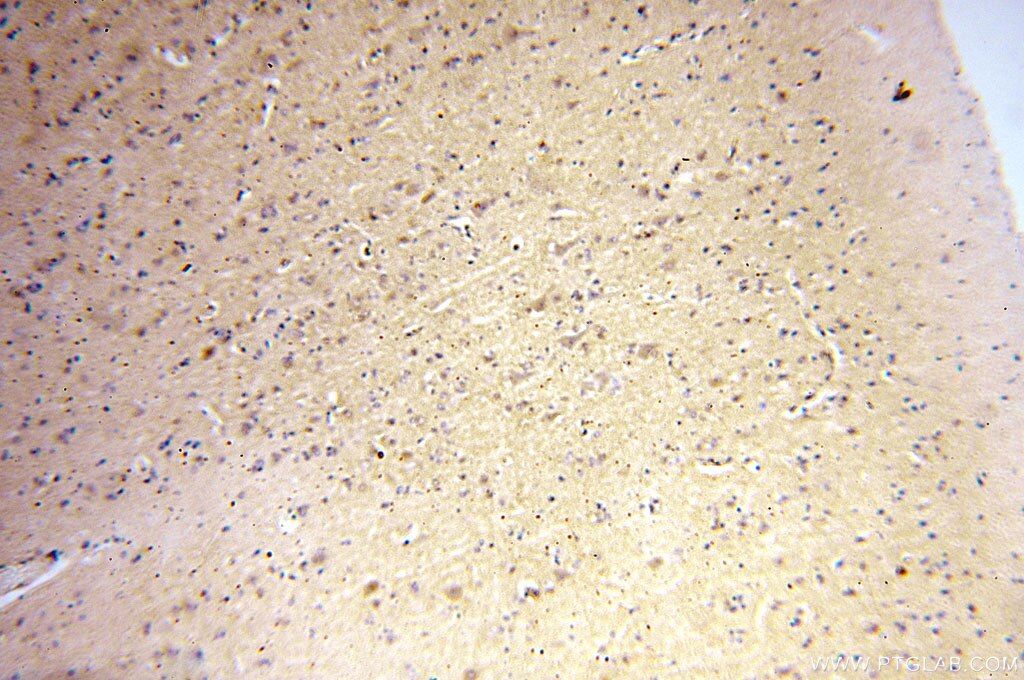 Immunohistochemistry (IHC) staining of human brain tissue using MCTP2 Polyclonal antibody (17578-1-AP)