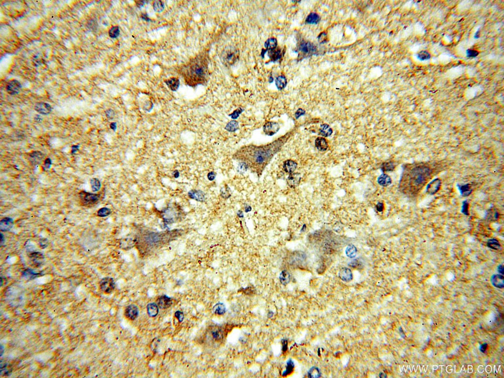 IHC staining of human brain using 17578-1-AP