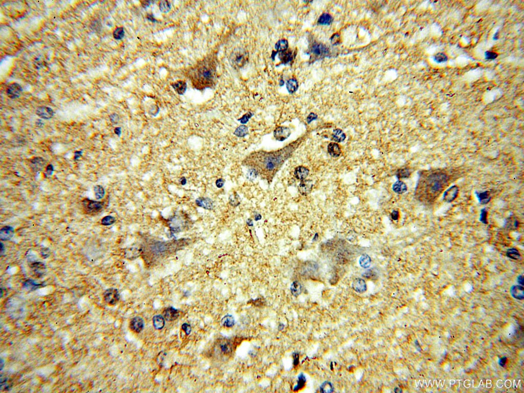 Immunohistochemistry (IHC) staining of human brain tissue using MCTP2 Polyclonal antibody (17578-1-AP)