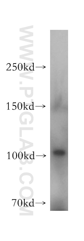 Western Blot (WB) analysis of mouse liver tissue using MCTP2 Polyclonal antibody (17578-1-AP)