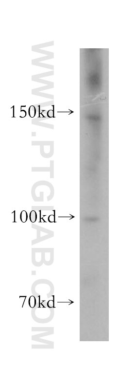 Western Blot (WB) analysis of human placenta tissue using MCTP2 Polyclonal antibody (17578-1-AP)