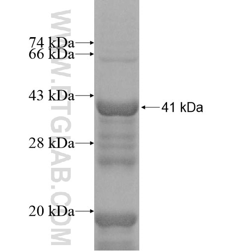 MCTP2 fusion protein Ag11089 SDS-PAGE