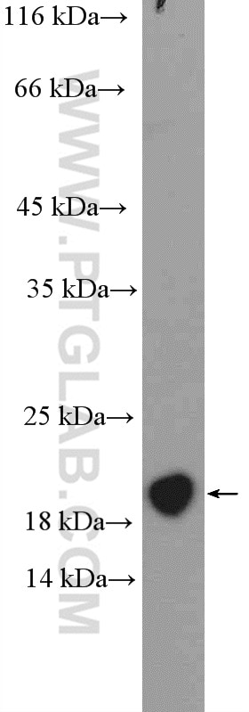 Western Blot (WB) analysis of mouse bladder tissue using MCTS1 Polyclonal antibody (14984-1-AP)