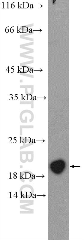 Western Blot (WB) analysis of mouse bladder tissue using MCTS1 Polyclonal antibody (14984-1-AP)