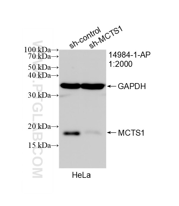 Western Blot (WB) analysis of HeLa cells using MCTS1 Polyclonal antibody (14984-1-AP)