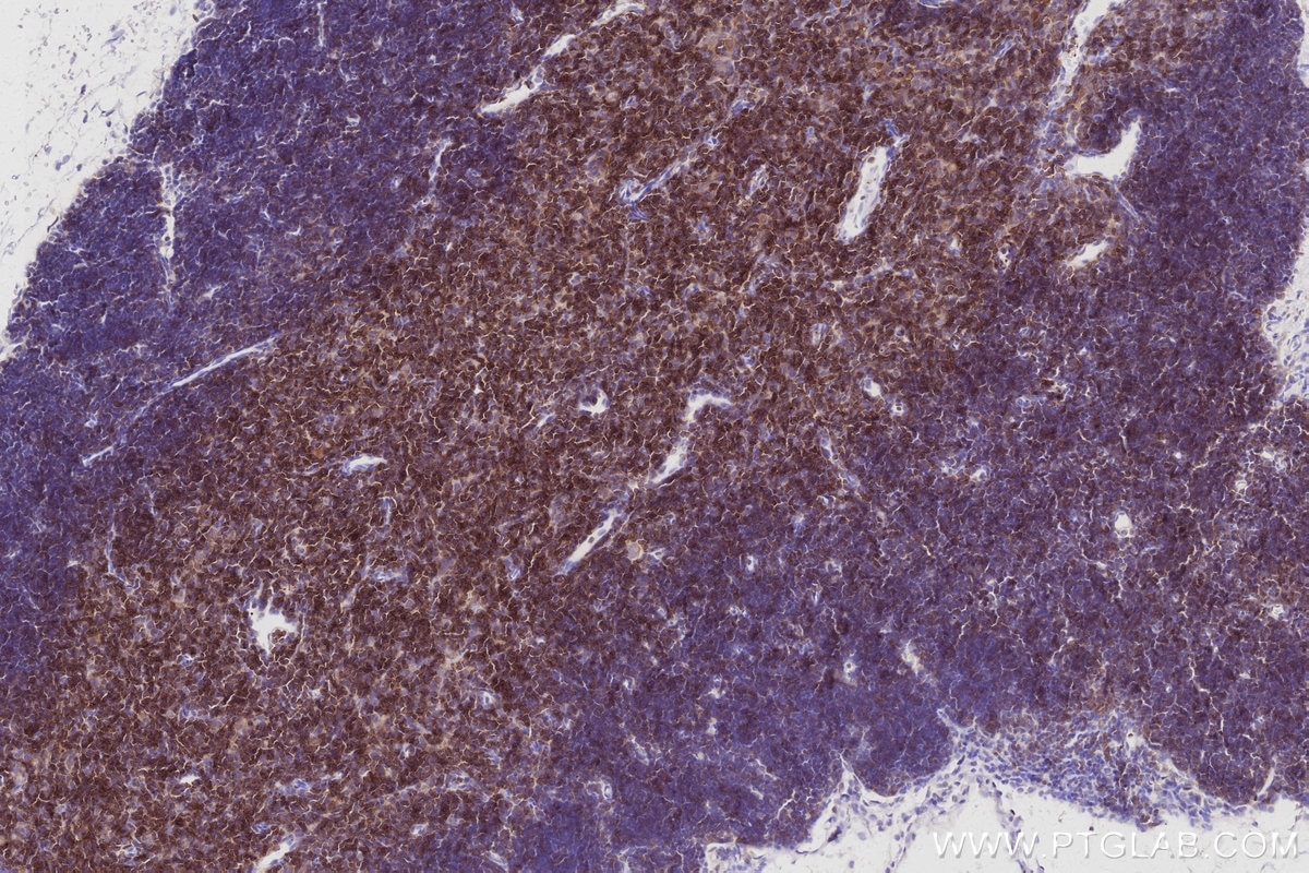 Immunohistochemistry (IHC) staining of mouse thymus tissue using MCTS1 Recombinant monoclonal antibody (84312-5-RR)