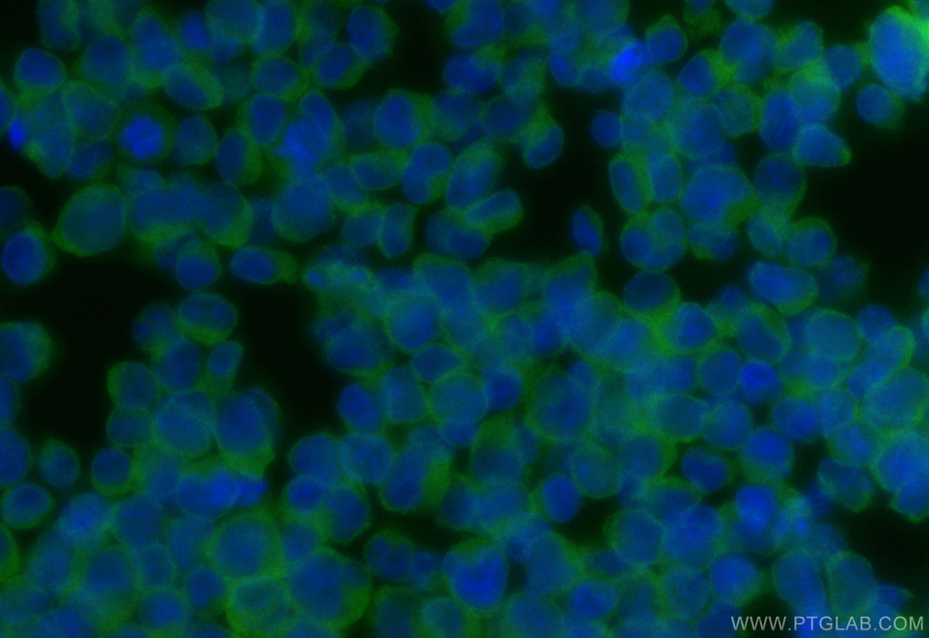 Immunofluorescence (IF) / fluorescent staining of Jurkat cells using CoraLite® Plus 488-conjugated MCTS1 Recombinant an (CL488-84312-5)