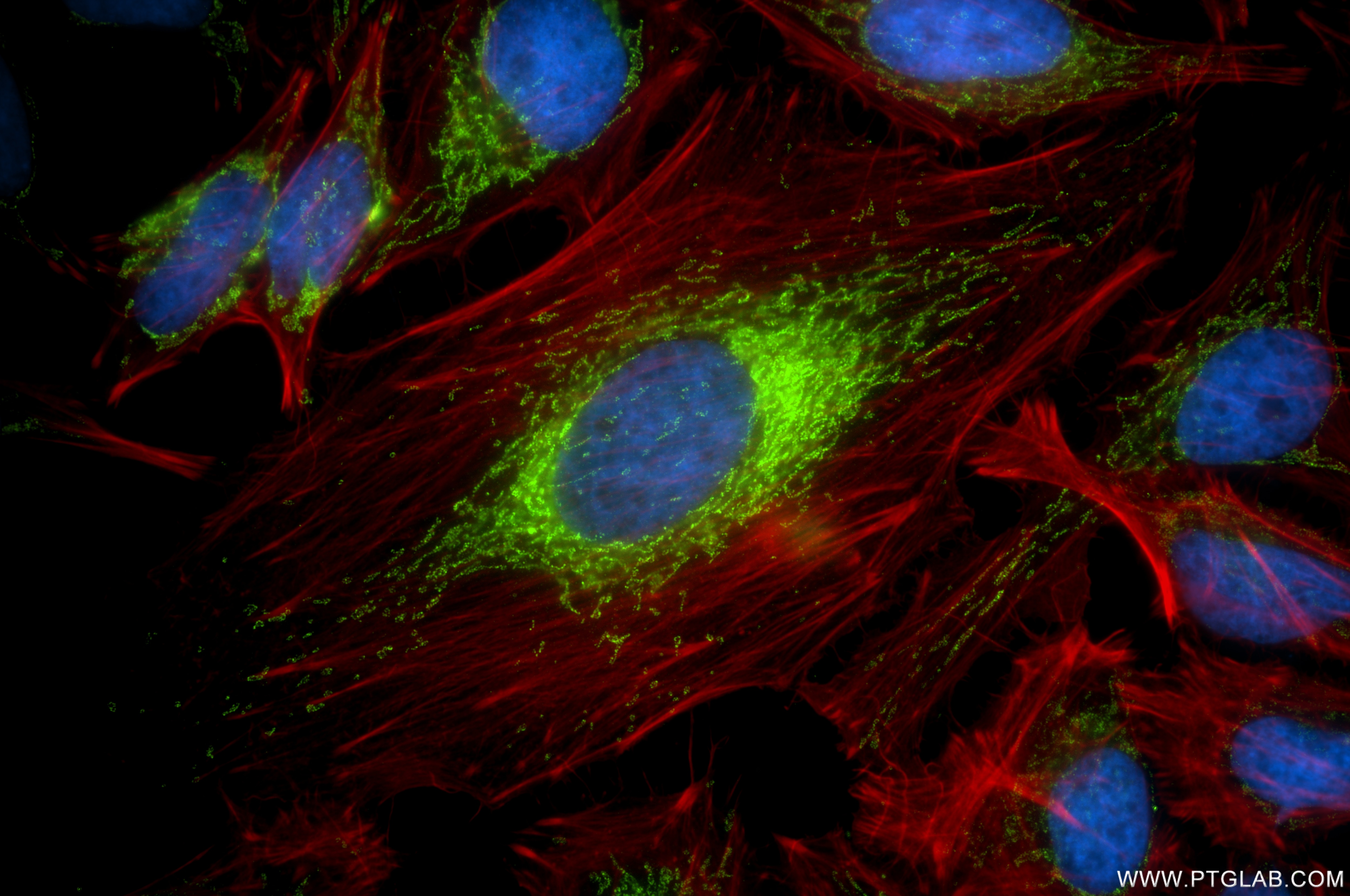 Immunofluorescence (IF) / fluorescent staining of HeLa cells using MCU/CCDC109A Recombinant monoclonal antibody (86274-1-RR)