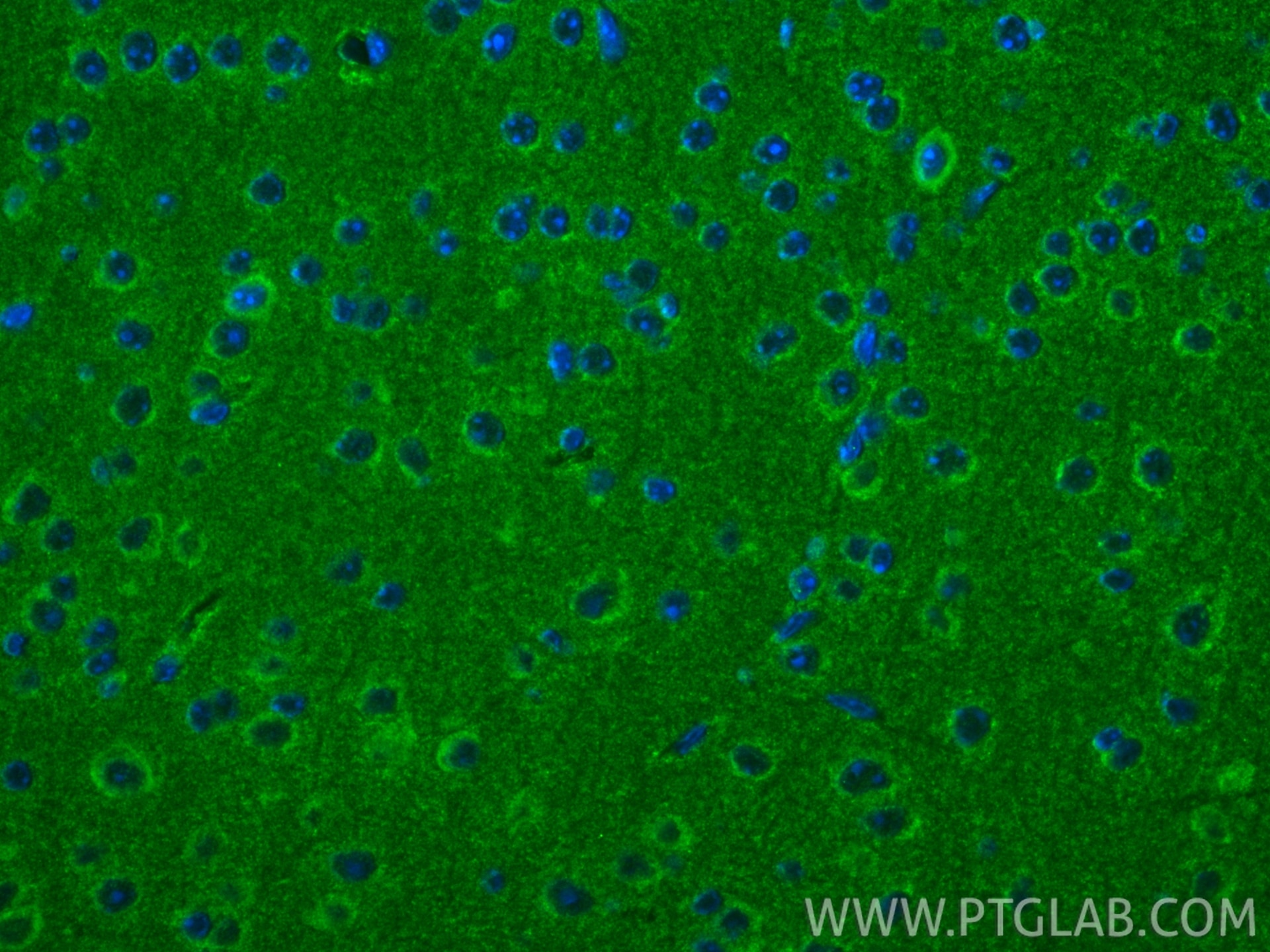 IF Staining of mouse brain using 24948-1-AP (same clone as 24948-1-PBS) Immunofluorescence (IF) / fluorescent staining of mouse brain tissue using MCUR1 Polyclonal antibody (24948-1-AP)