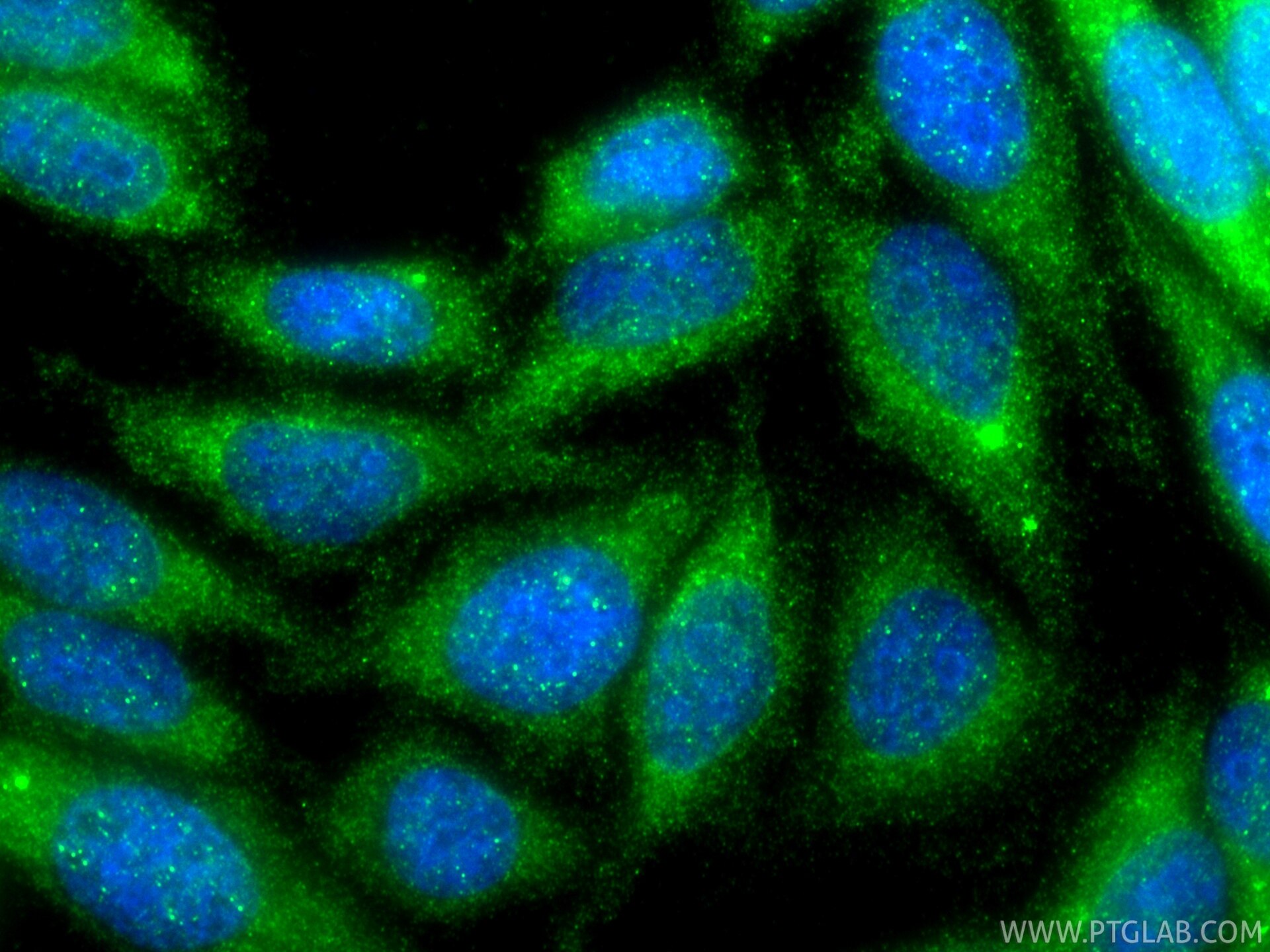 Immunofluorescence (IF) / fluorescent staining of HepG2 cells using MCUR1 Polyclonal antibody (24948-1-AP)