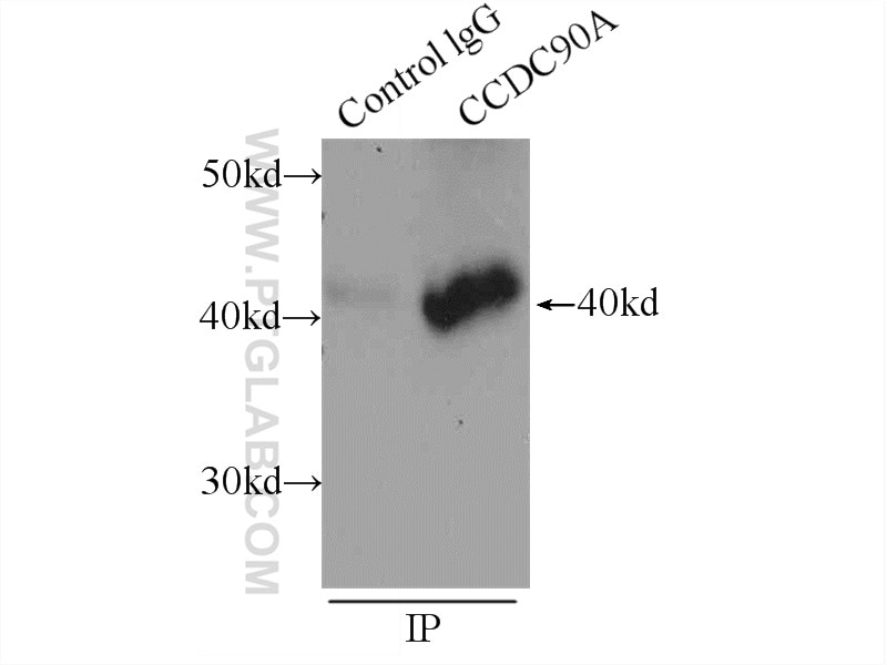 Immunoprecipitation (IP) experiment of HEK-293 cells using MCUR1 Polyclonal antibody (24948-1-AP)