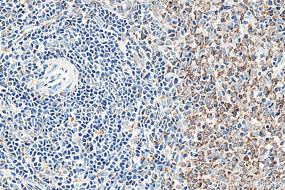 IHC staining of rat spleen using 34213-1-AP Immunohistochemistry (IHC) staining of rat spleen tissue using MD-1 Polyclonal antibody (34213-1-AP)