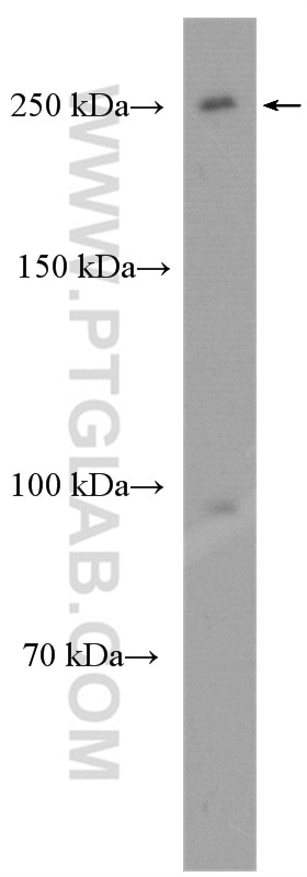 Western Blot (WB) analysis of HeLa cells using MDC1 Polyclonal antibody (22272-1-AP)