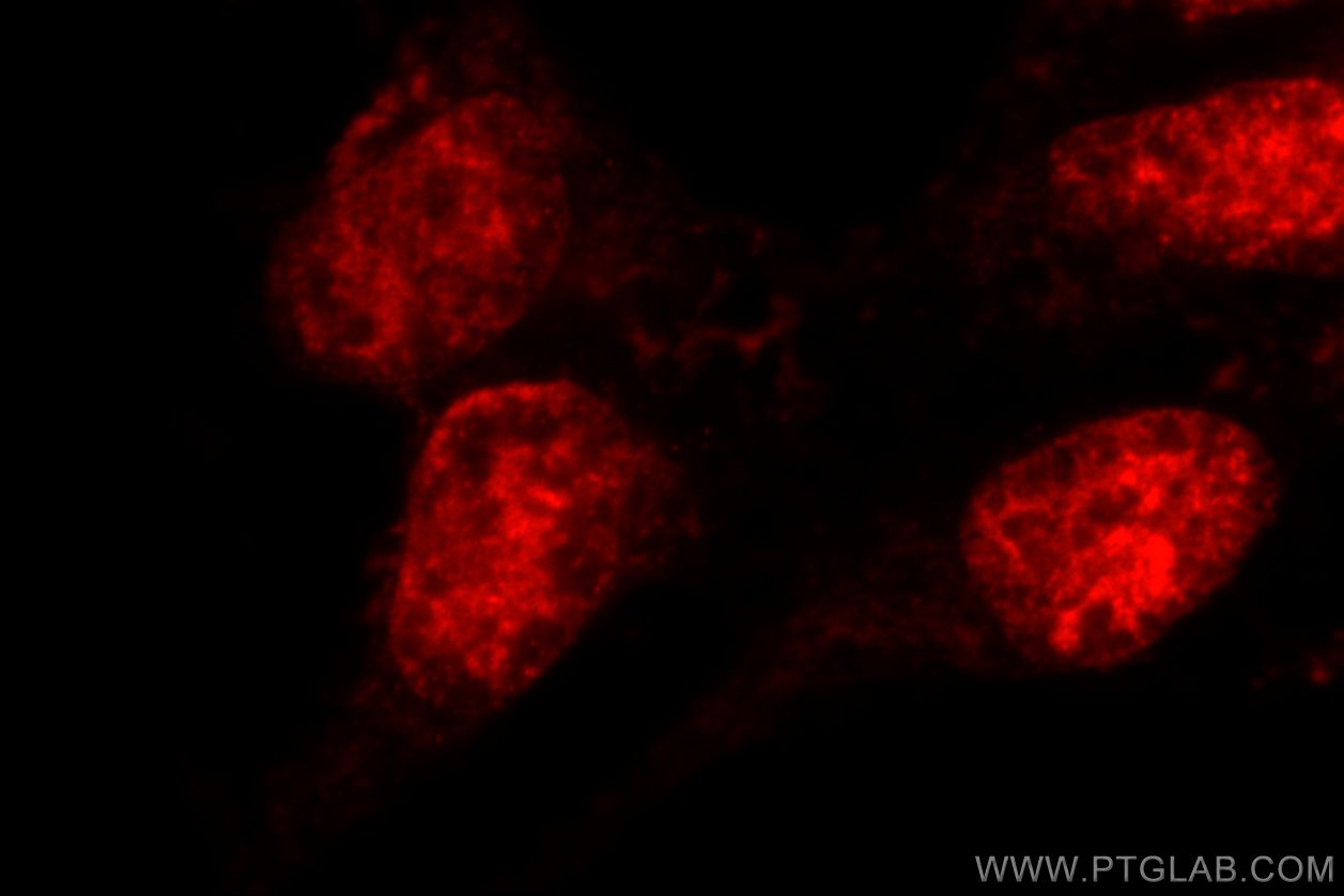 Immunofluorescence (IF) / fluorescent staining of HEK-293 cells using MDC1 Polyclonal antibody (24721-1-AP)
