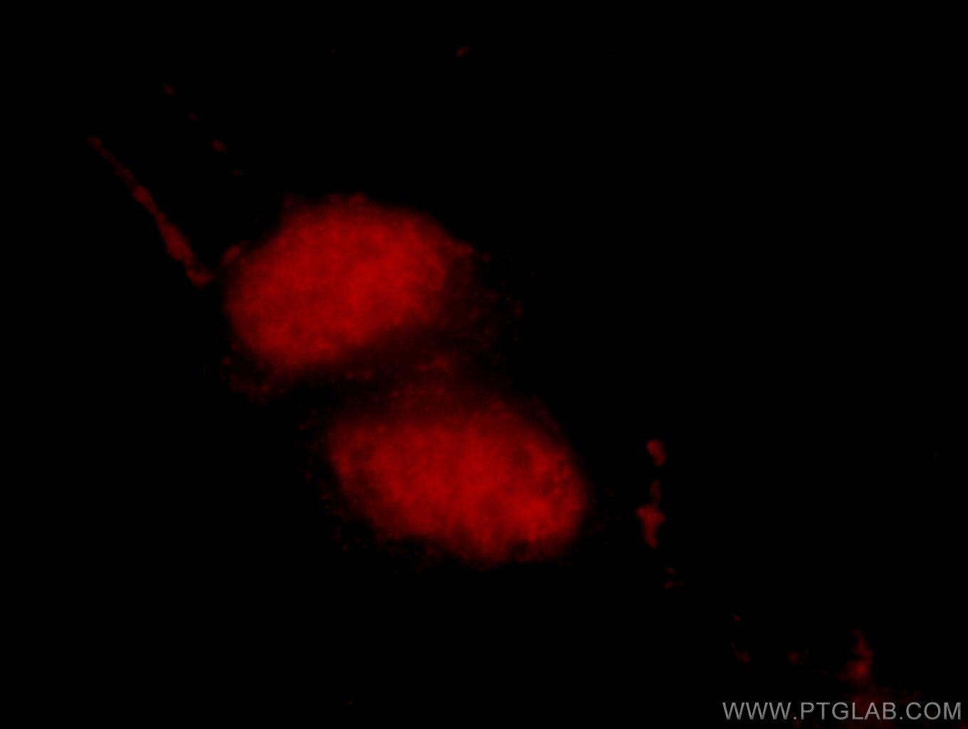 Immunofluorescence (IF) / fluorescent staining of HeLa cells using MDC1 Polyclonal antibody (24721-1-AP)