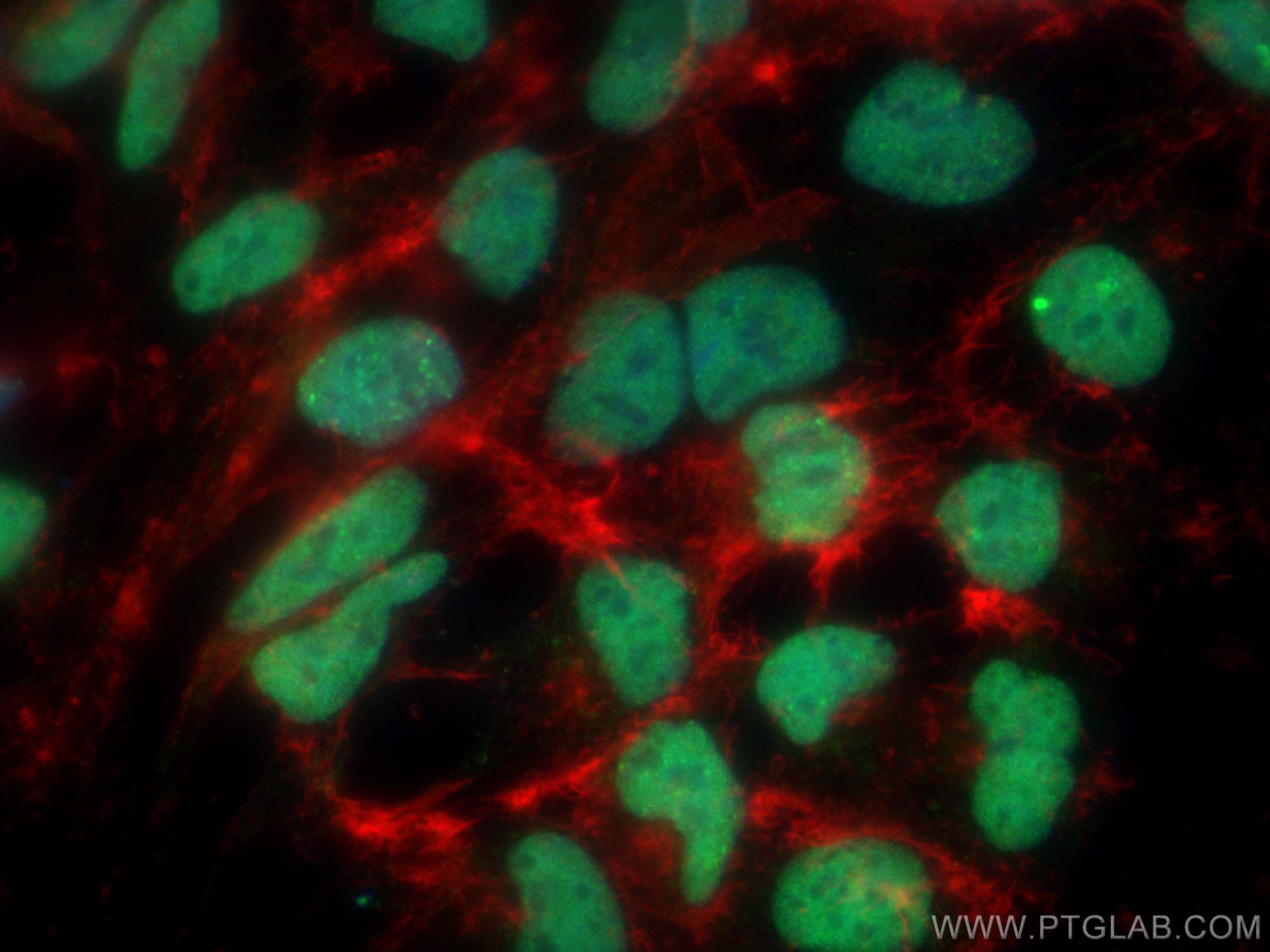Immunofluorescence (IF) / fluorescent staining of HEK-293 cells using MDC1 Polyclonal antibody (24721-1-AP)