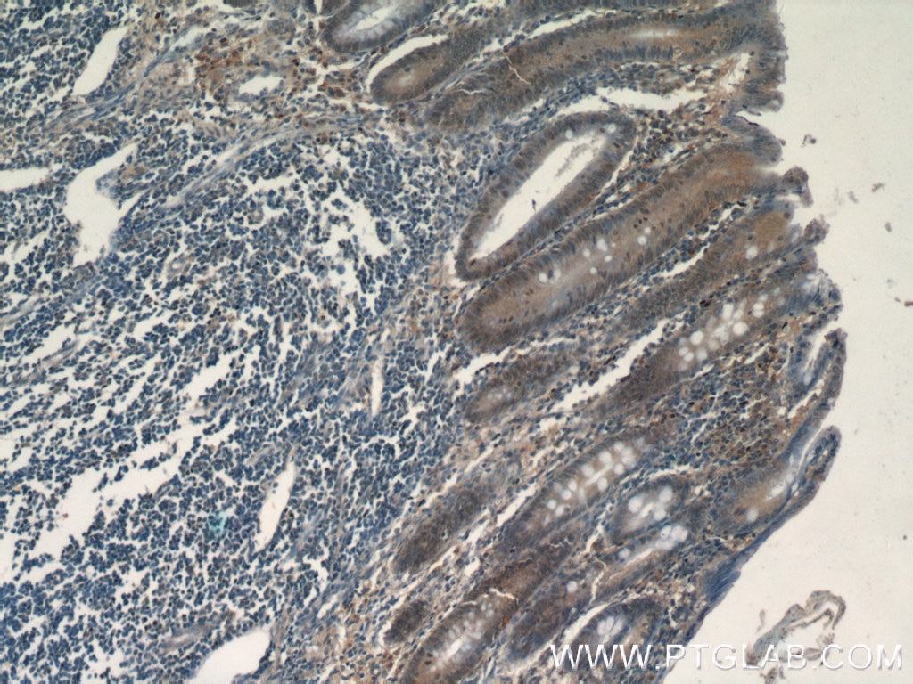 Immunohistochemistry (IHC) staining of human appendix tissue using MDC1 Polyclonal antibody (24721-1-AP)