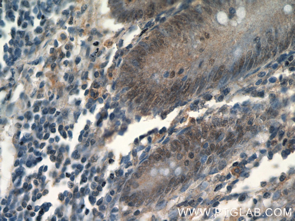 Immunohistochemistry (IHC) staining of human appendix tissue using MDC1 Polyclonal antibody (24721-1-AP)