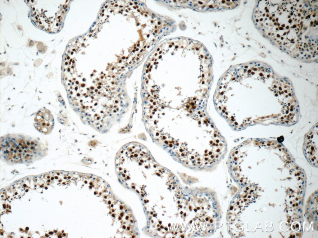 Immunohistochemistry (IHC) staining of human testis tissue using MDC1 Polyclonal antibody (24721-1-AP)