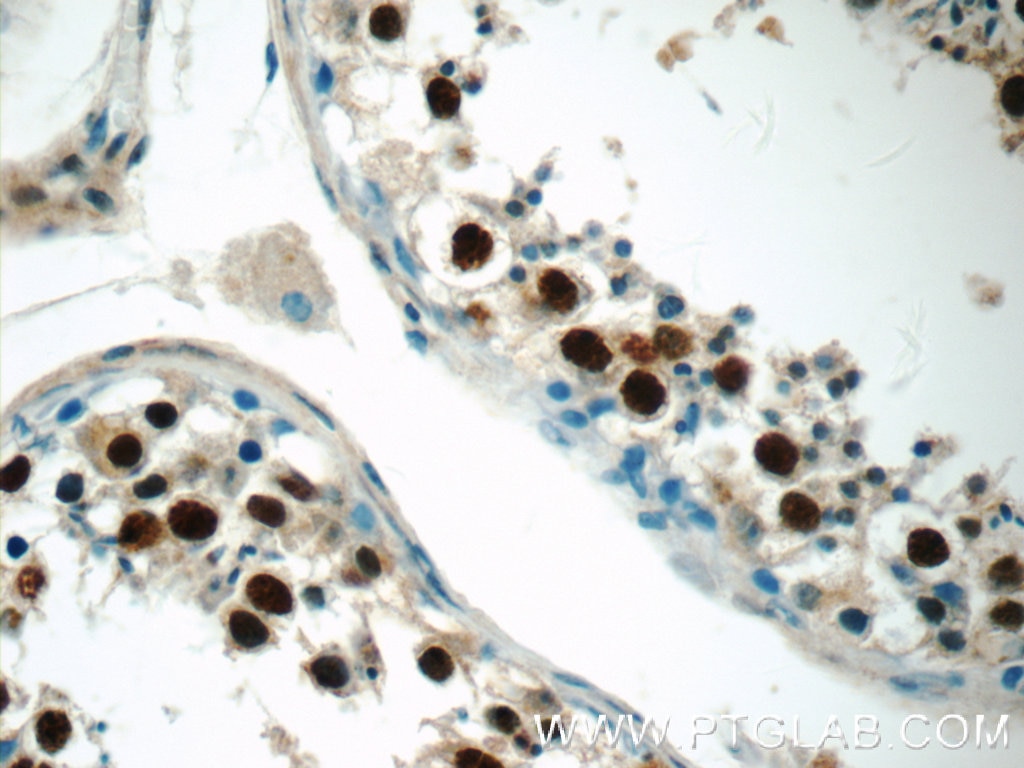 Immunohistochemistry (IHC) staining of human testis tissue using MDC1 Polyclonal antibody (24721-1-AP)