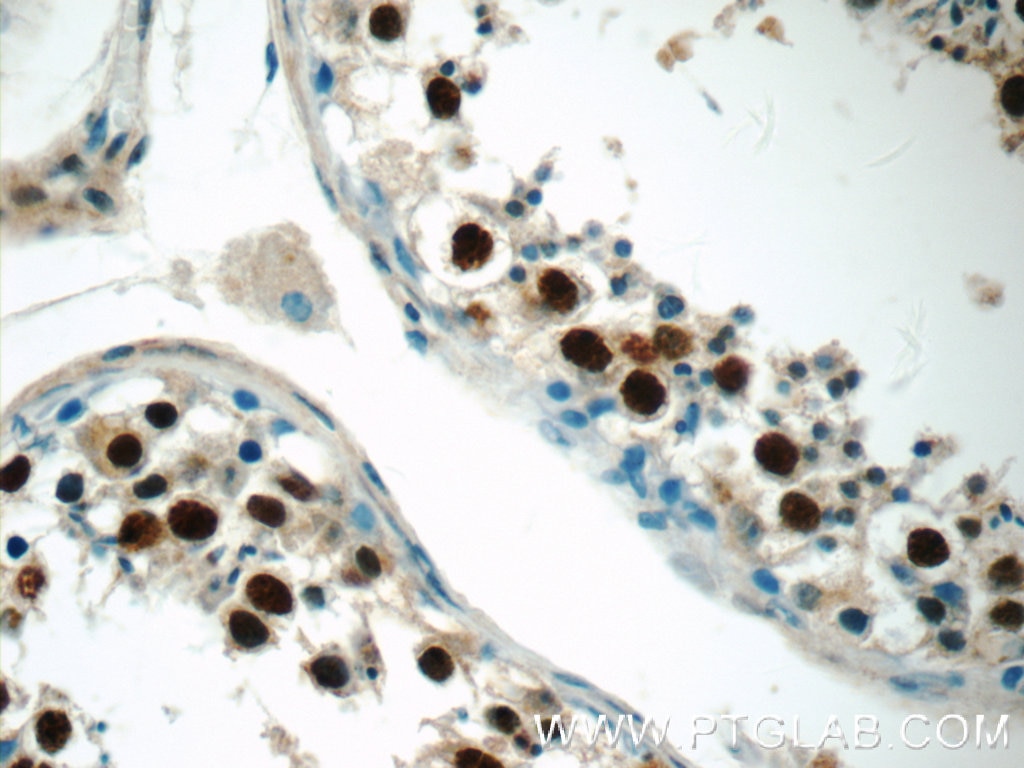 IHC staining of human testis using 24721-1-AP