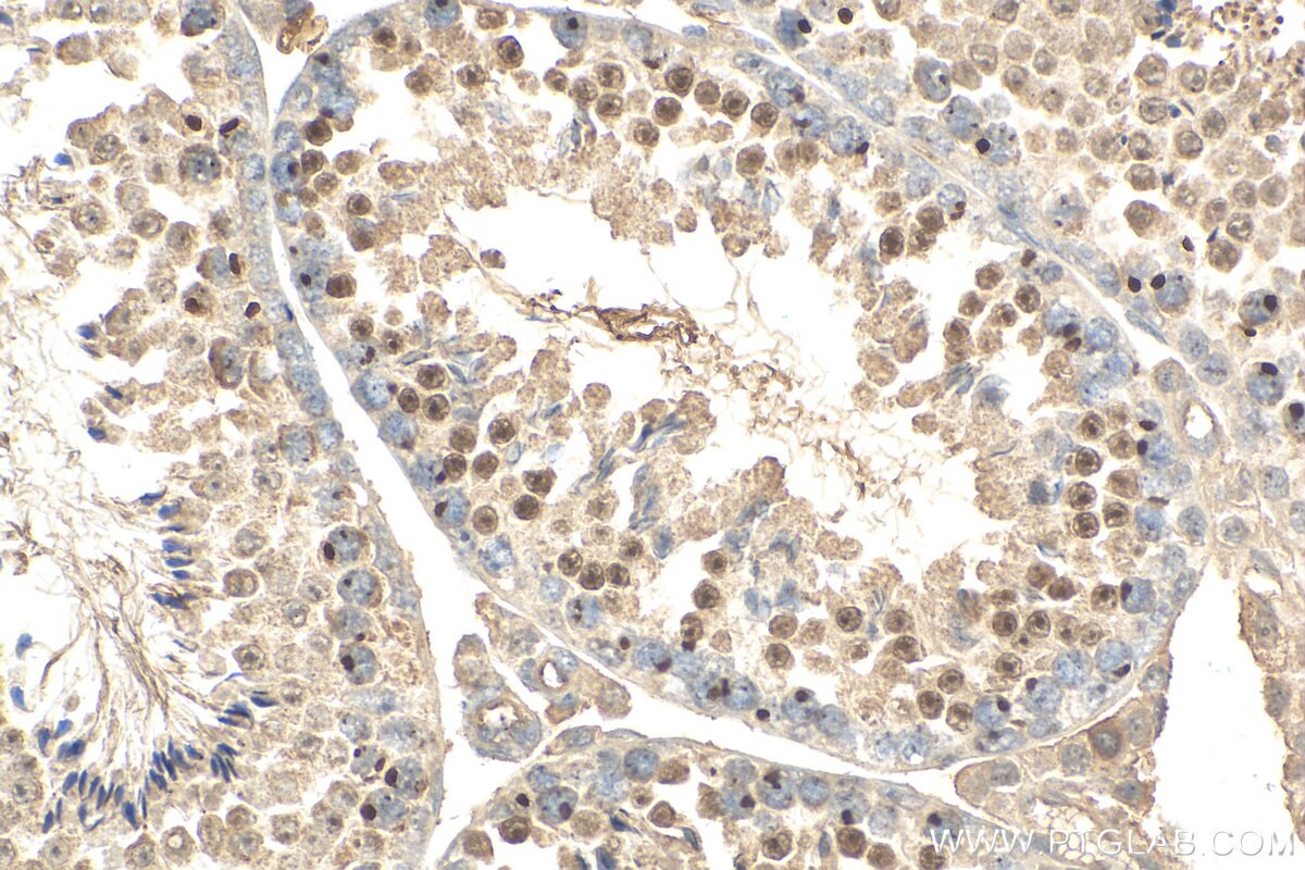 Immunohistochemistry (IHC) staining of mouse testis tissue using MDC1 Polyclonal antibody (24721-1-AP)