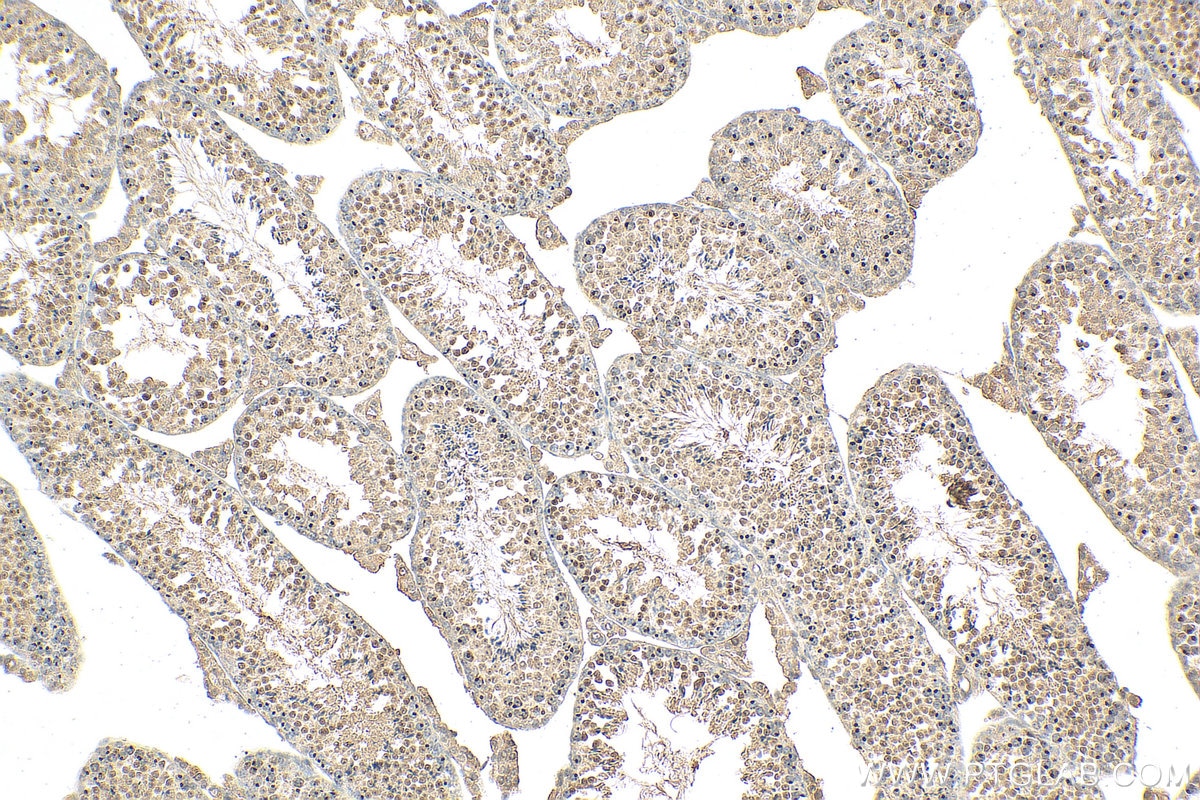 Immunohistochemistry (IHC) staining of mouse testis tissue using MDC1 Polyclonal antibody (24721-1-AP)