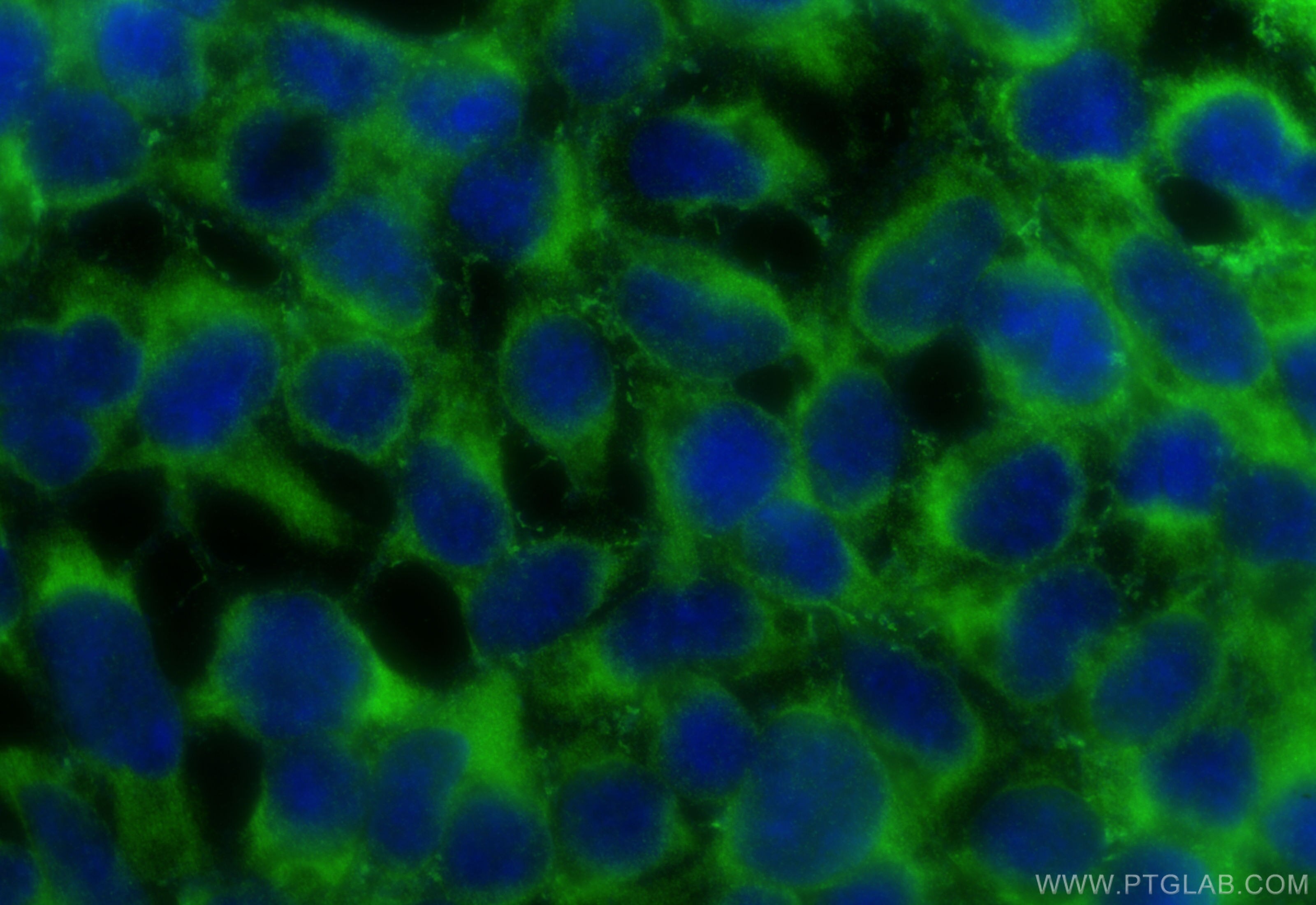 Immunofluorescence (IF) / fluorescent staining of HEK-293 cells using MDFIC Polyclonal antibody (31740-1-AP)