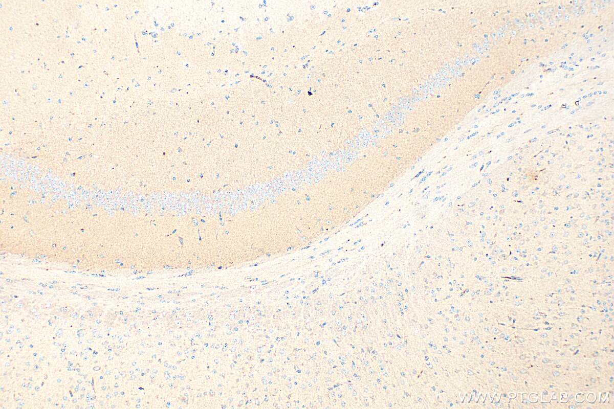 Immunohistochemical analysis of paraffin-embedded mouse brain tissue slide using 33775-1-AP (MDGA1 antibody) at dilution of 1:400 (under 10x lens). Heat mediated antigen retrieval with Tris-EDTA buffer (pH 9.0). Immunohistochemistry (IHC) staining of mouse brain tissue using MDGA1 Polyclonal antibody (33775-1-AP)