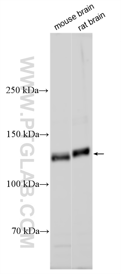 Various lysates were subjected to SDS PAGE followed by western blot with 33775-1-AP (MDGA1 antibody) at dilution of 1:500 incubated at room temperature for 1.5 hours. Western Blot (WB) analysis of various lysates using MDGA1 Polyclonal antibody (33775-1-AP)