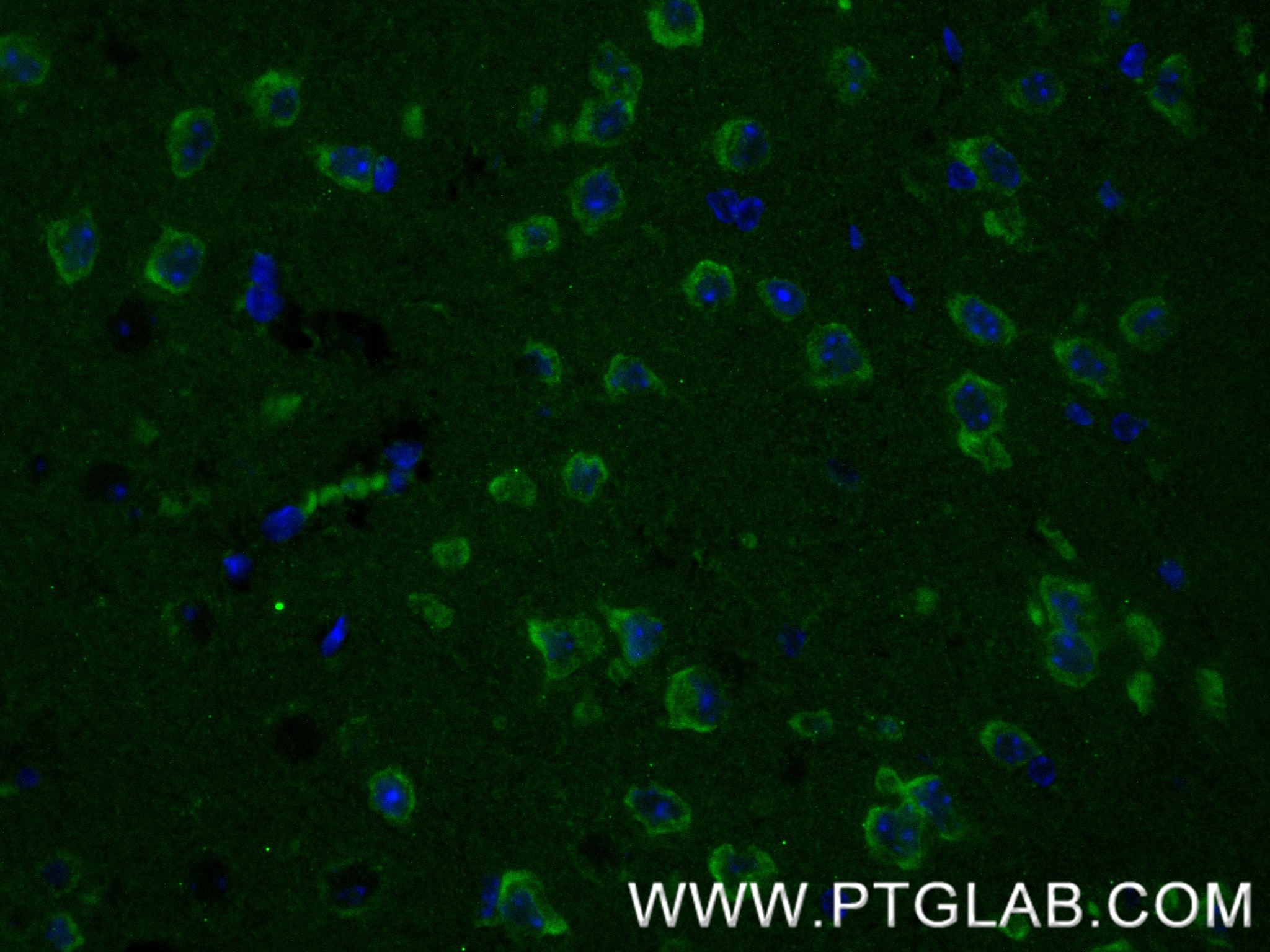 IF Staining of mouse brain using 87078-1-RR (same clone as 87078-1-PBS) Immunofluorescence (IF) / fluorescent staining of mouse brain tissue using MDGA1 Recombinant monoclonal antibody (87078-1-RR)