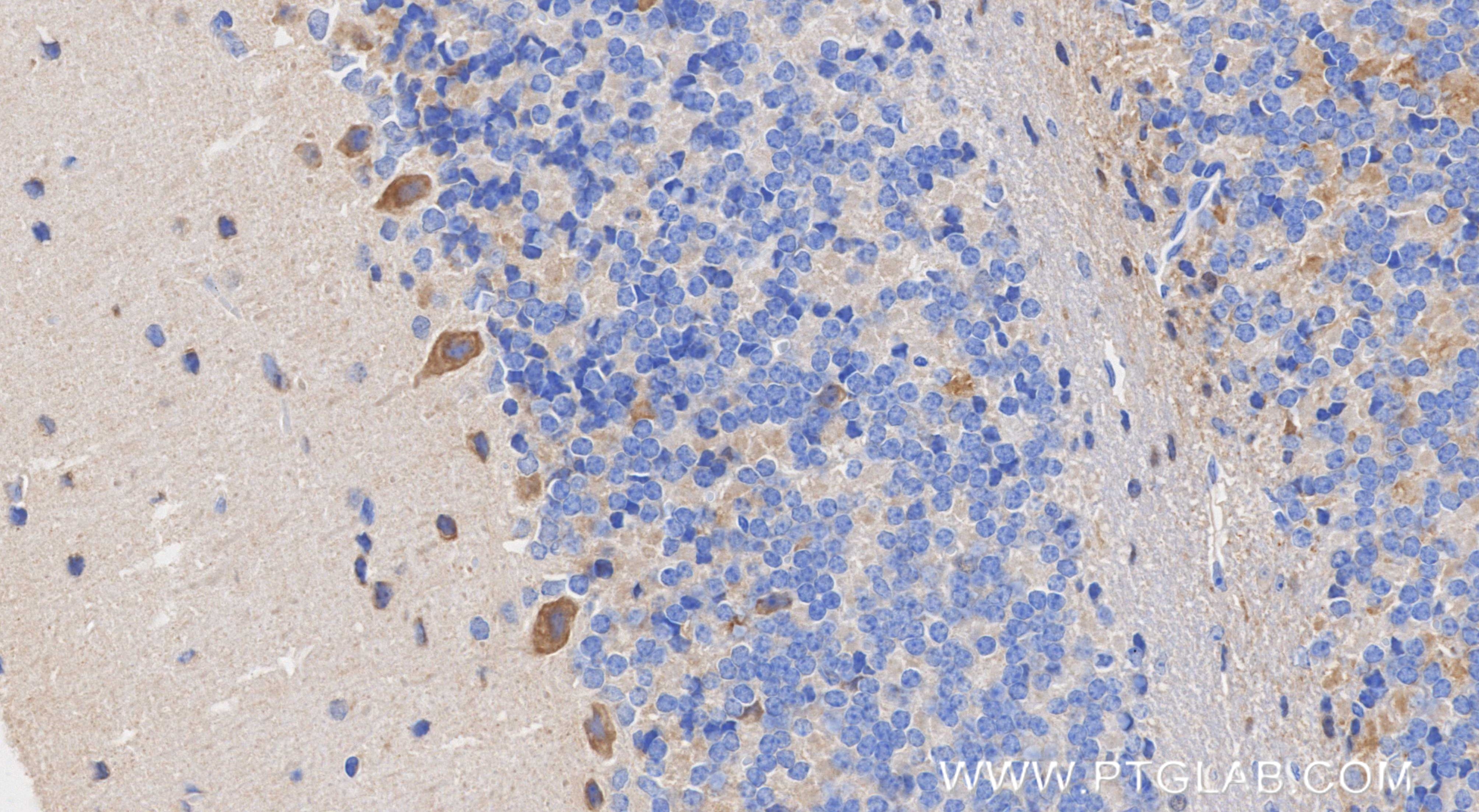 IHC staining of mouse cerebellum using 87078-1-RR Immunohistochemistry (IHC) staining of mouse cerebellum tissue using MDGA1 Recombinant monoclonal antibody (87078-1-RR)