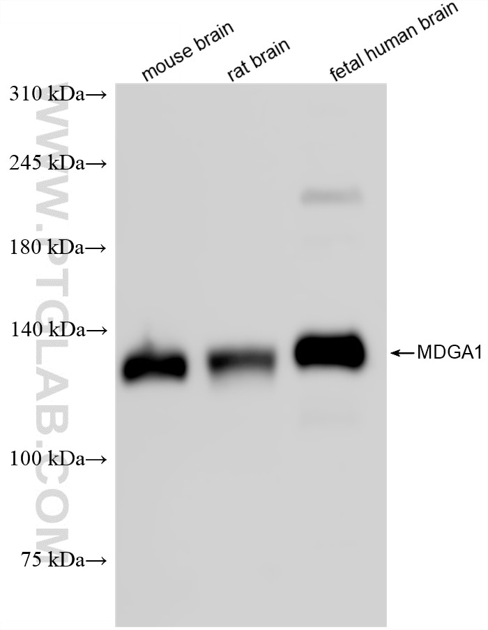 WB analysis using 87078-1-RR Western Blot (WB) analysis of various lysates using MDGA1 Recombinant monoclonal antibody (87078-1-RR)