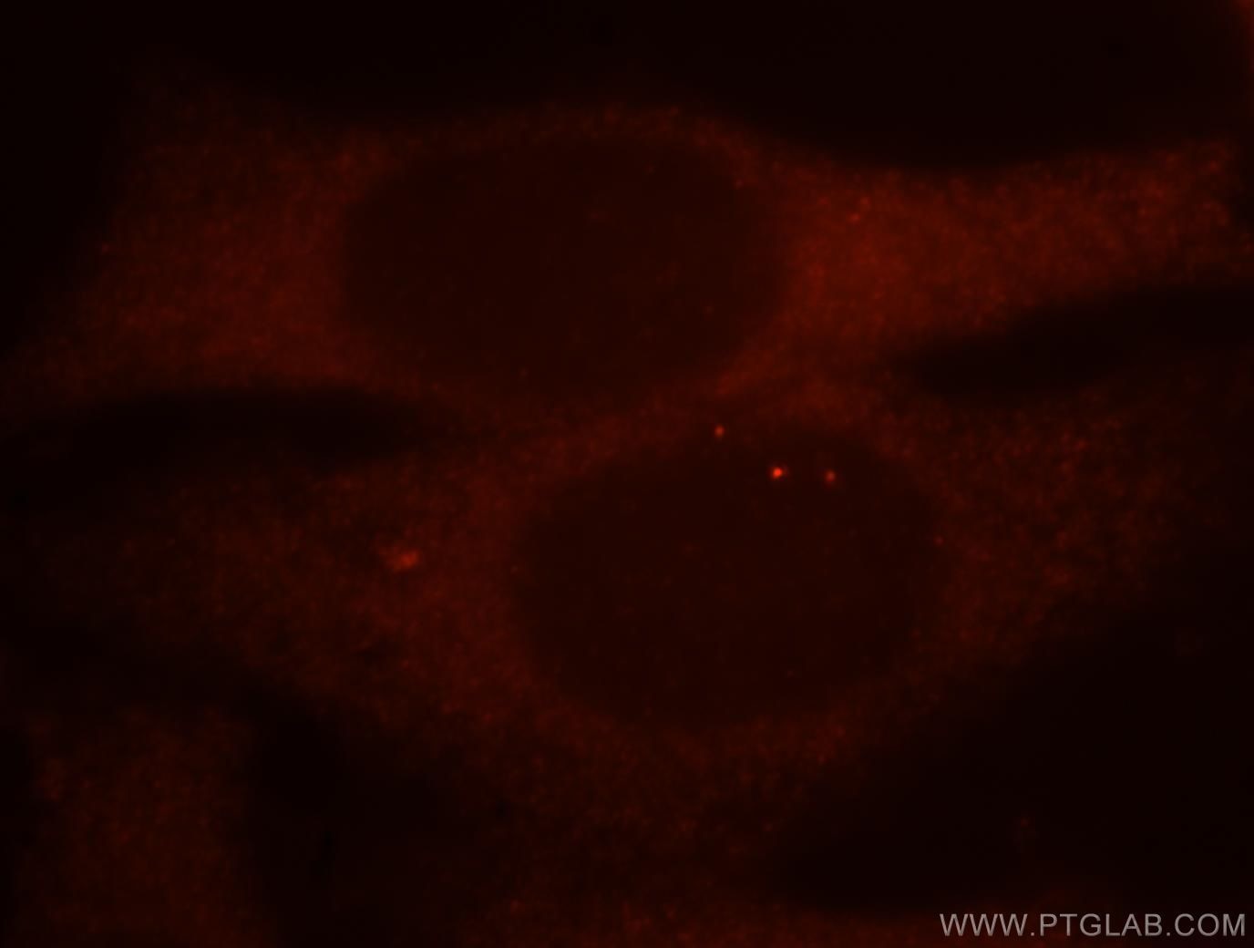Immunofluorescence (IF) / fluorescent staining of HepG2 cells using MDH1 Polyclonal antibody (15904-1-AP)