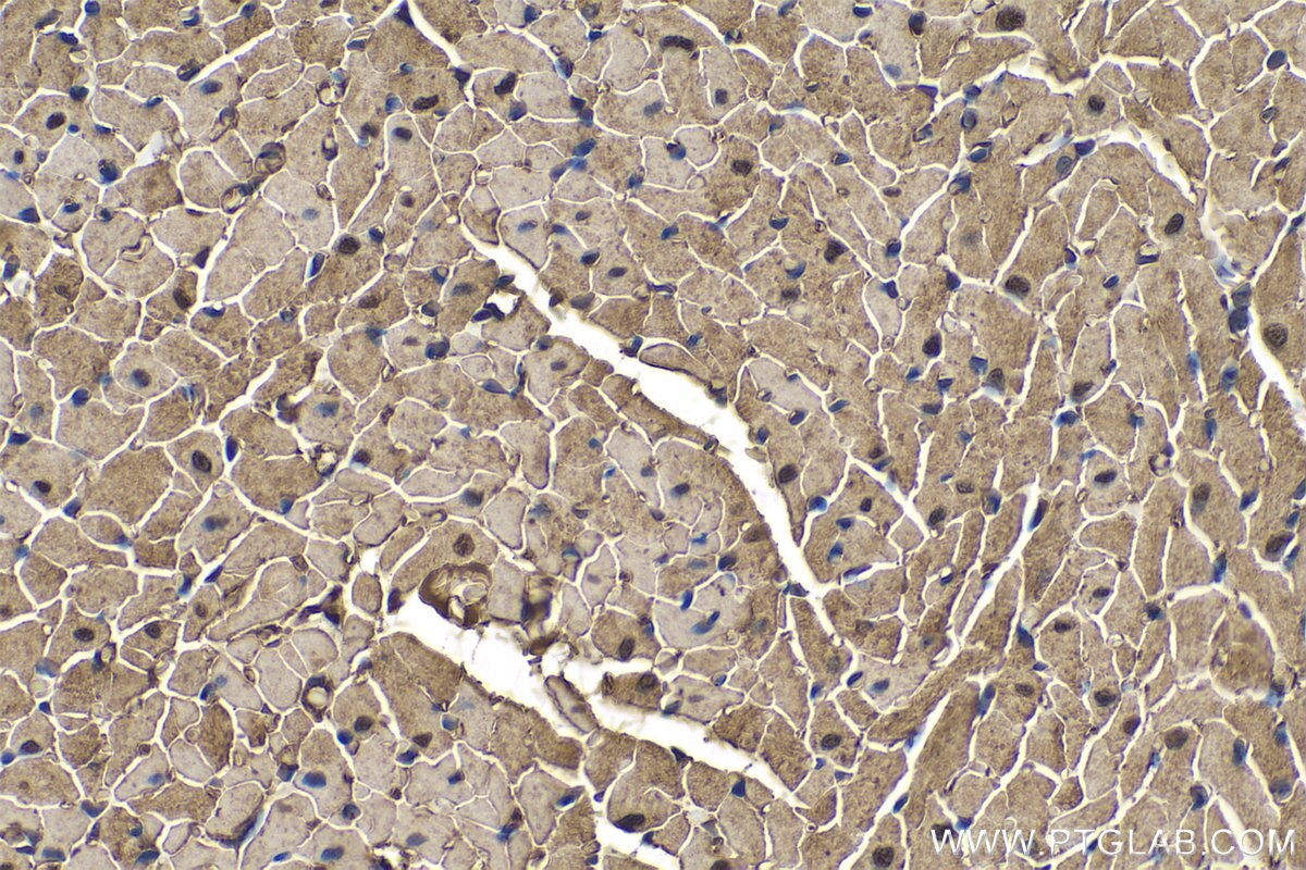 IHC staining of rat heart using 15904-1-AP