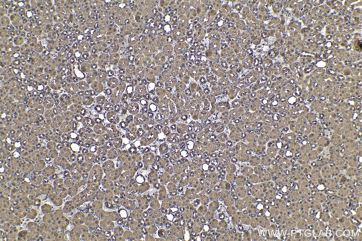 Immunohistochemistry (IHC) staining of mouse kidney tissue using MDH1 Polyclonal antibody (15904-1-AP)