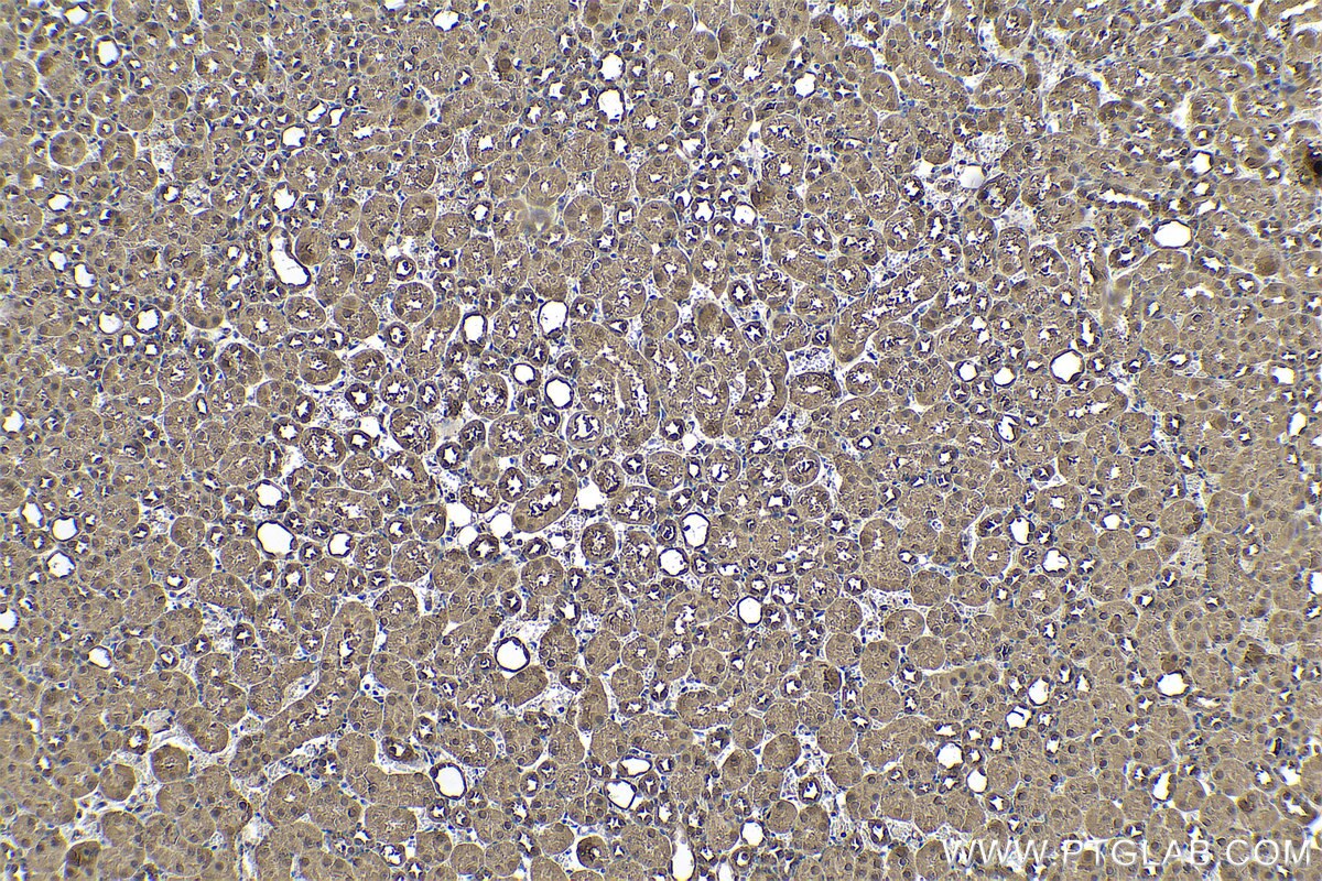 Immunohistochemistry (IHC) staining of mouse kidney tissue using MDH1 Polyclonal antibody (15904-1-AP)