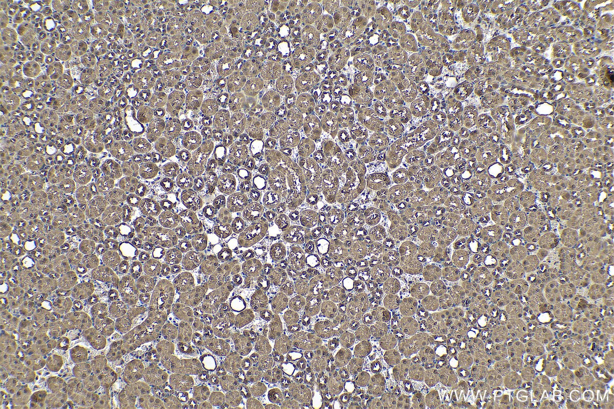 Immunohistochemistry (IHC) staining of mouse kidney tissue using MDH1 Polyclonal antibody (15904-1-AP)